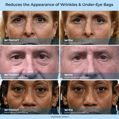 🔥Letzter Tagesverkauf: 49 % Rabatt auf LBMLBM-HOYGI™ 60-Sekunden-Anti-Aging-Serum gegen Falten, Tränensäcke und Augenringe